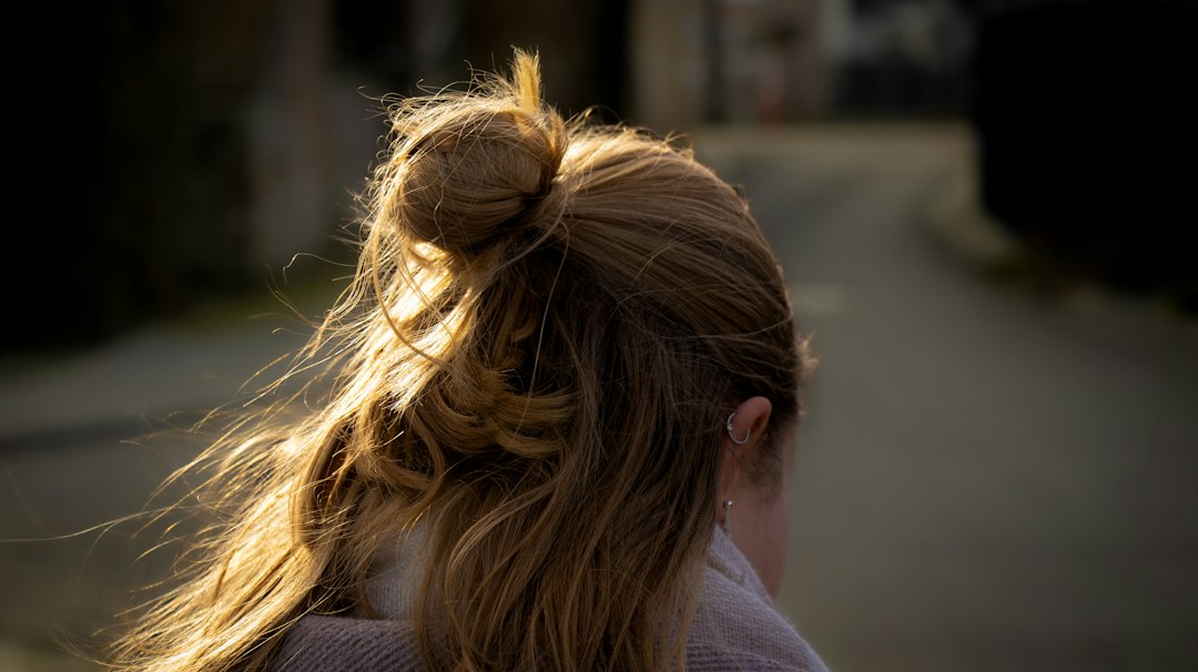 Chute de cheveux mixte chez la femme
